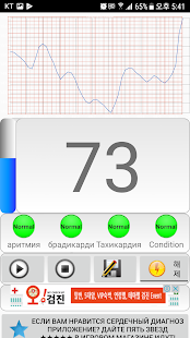 Программа Диагностика сердца (сердечный ритм, аритмия) на Андроид - Обновленная версия
